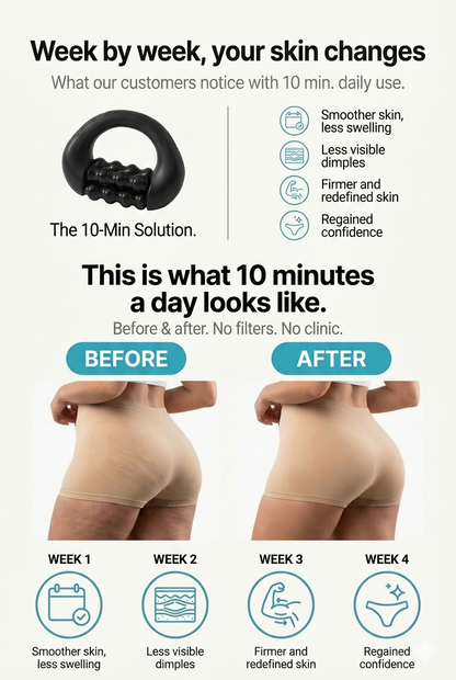 ALORIN™ SculptRoll Anti Rolling Cellulite Massager - Reduce Puffiness & Enhance Natural Contours